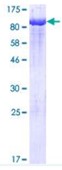 SDS-PAGE (PCK1-30553TH).jpg